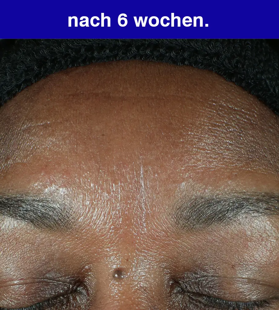 retinol correcting serum.