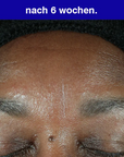 retinol correcting serum.
