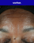 retinol correcting serum.