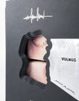 VULNUS